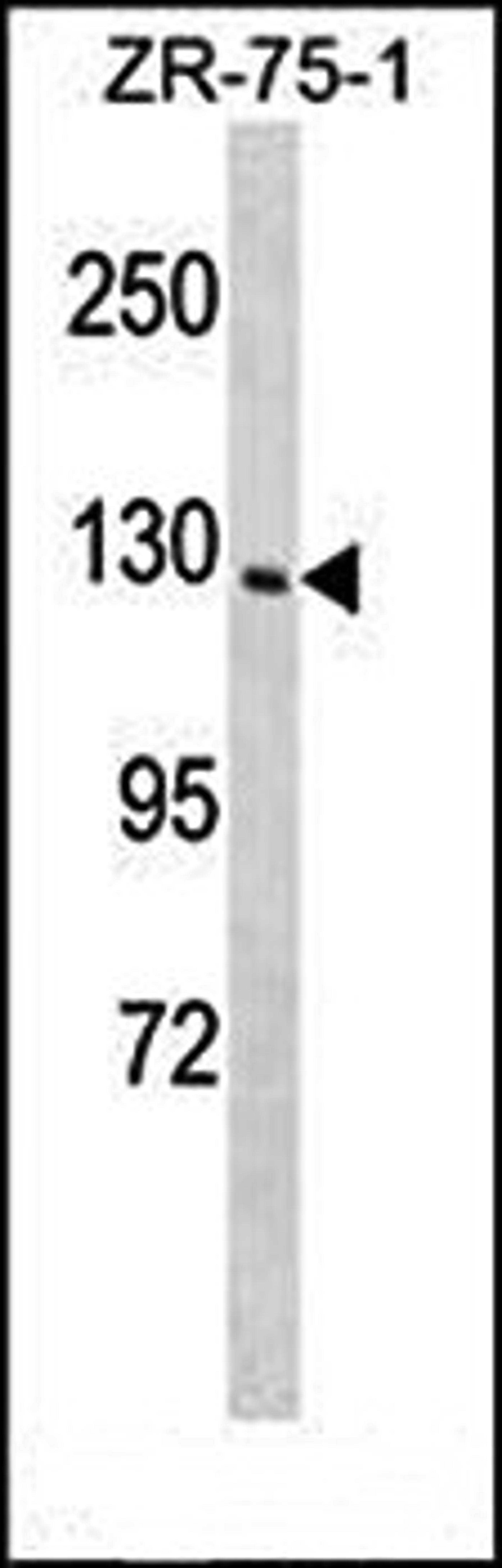 Western blot analysis of ZR-75-1 cell line lysates (35ug/lane) using PITPNM1 (N-term) antibody