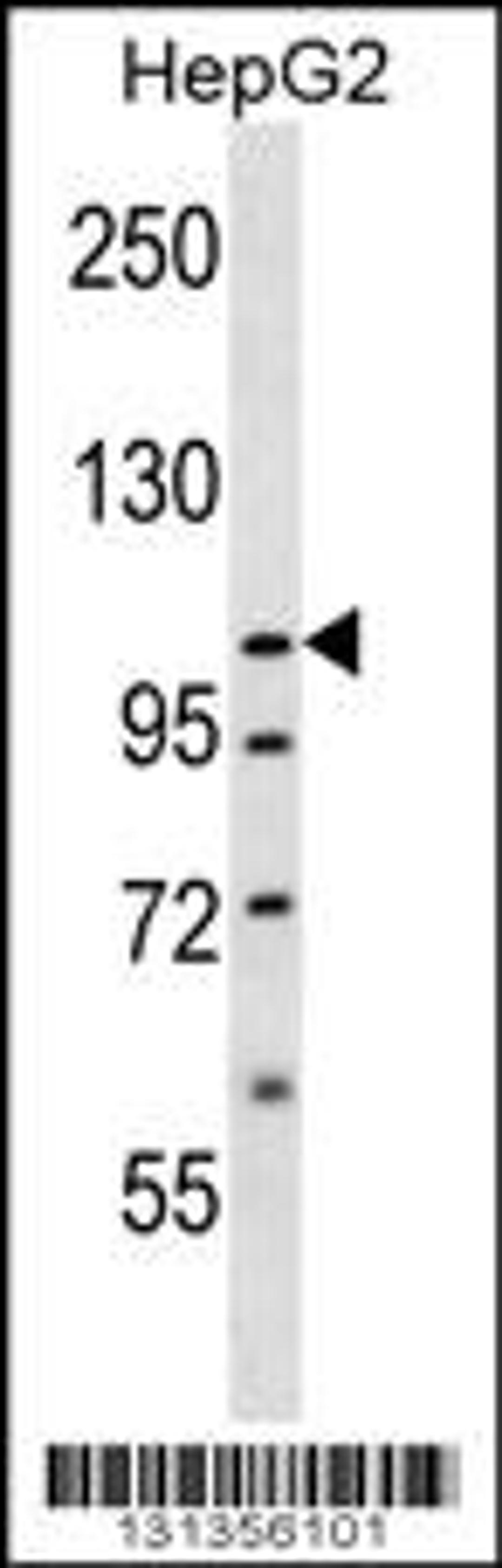 Western blot analysis in HepG2 cell line lysates (35ug/lane).