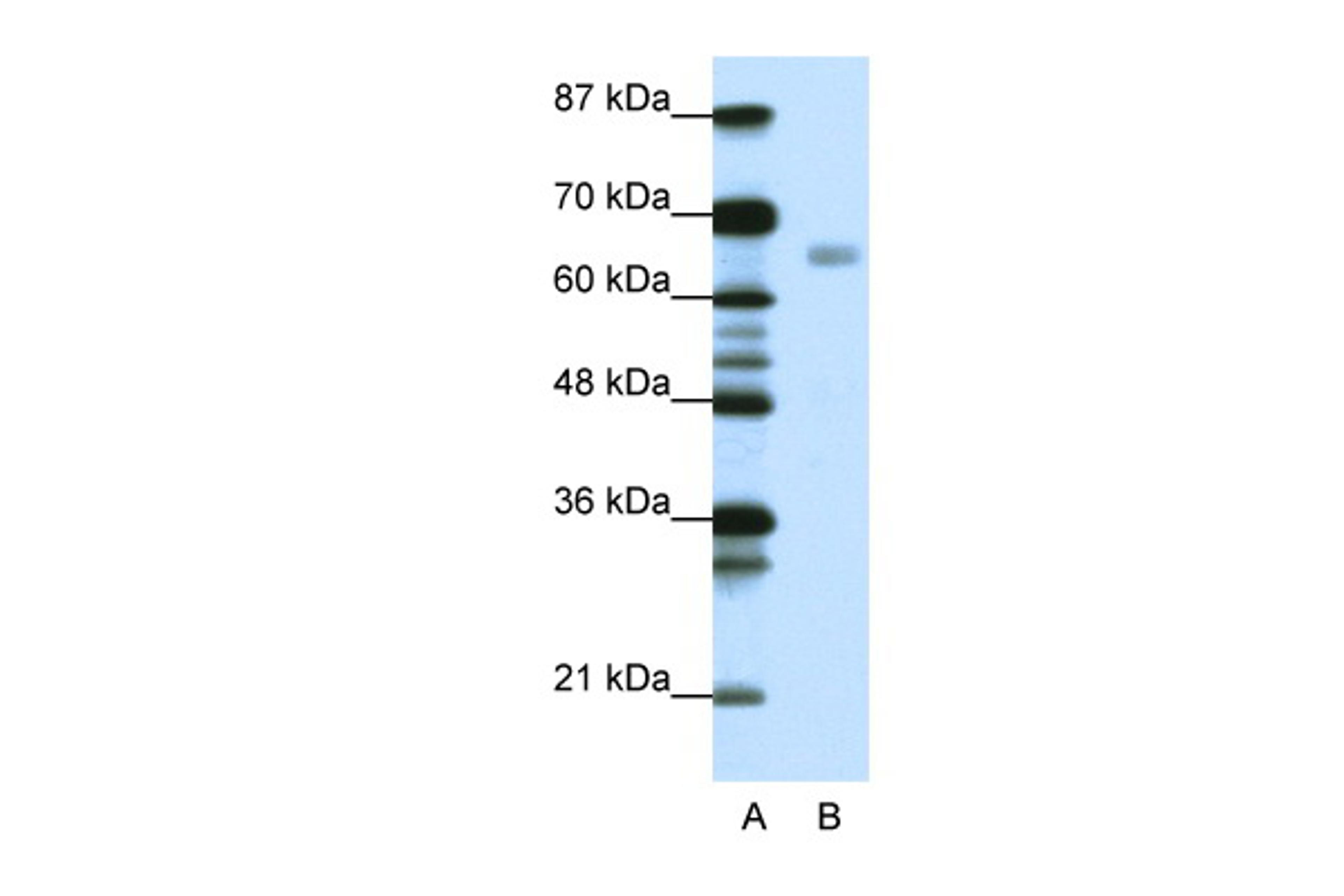 Antibody used in WB on Human Jurkat 0.0625 ug/ml.