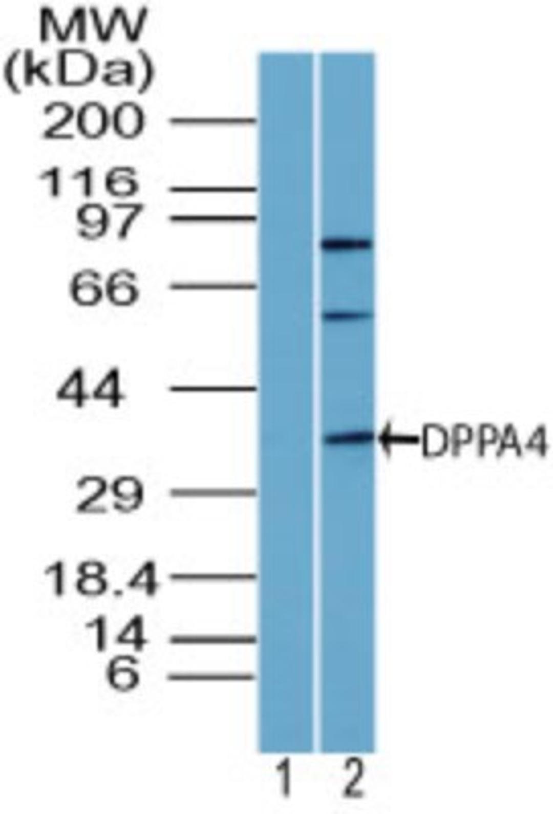 Western Blot: Dppa4 Antibody [NBP2-24656] - analysis of DPPA4 in human testis lysate using 1) pre-bleed and 2) this antibody. I goat anti-rabbit Ig HRP secondary antibody and PicoTect ECL substrate solution were used for this test.