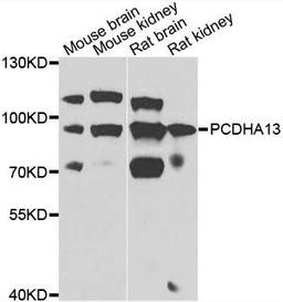 Western blot analysis of extracts of various cell lines using PCDHA13 antibody