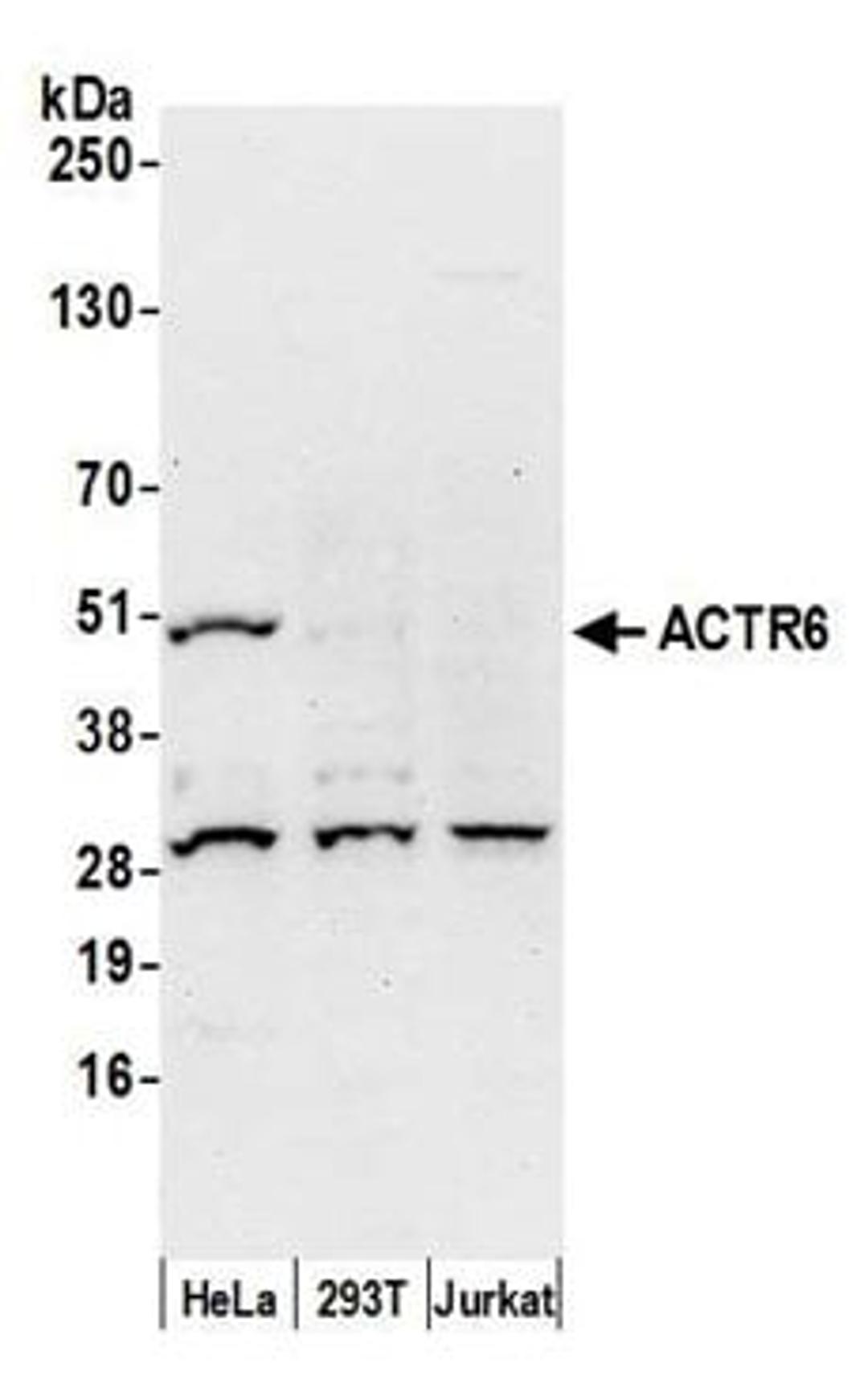 Detection of human ACTR6 by western blot.