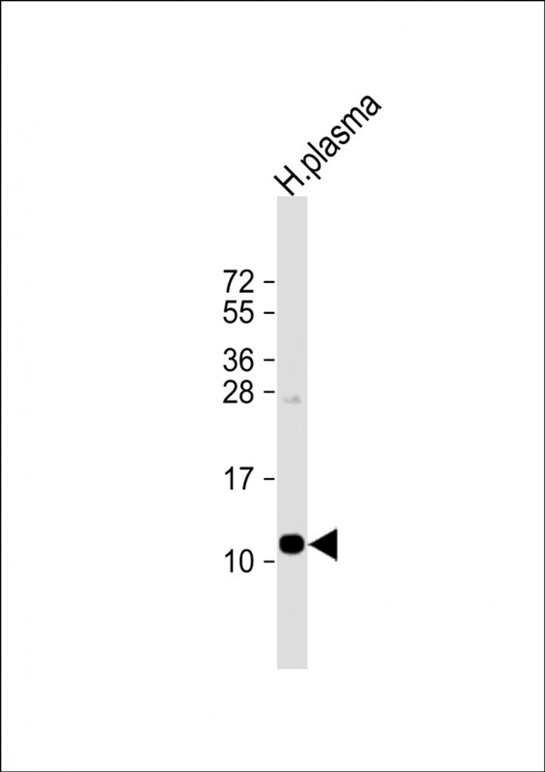 Western Blot at 1:1000 dilution + human plasma lysate Lysates/proteins at 20 ug per lane.