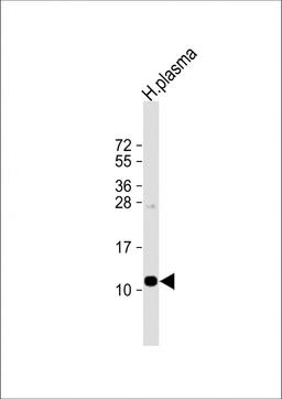 Western Blot at 1:1000 dilution + human plasma lysate Lysates/proteins at 20 ug per lane.