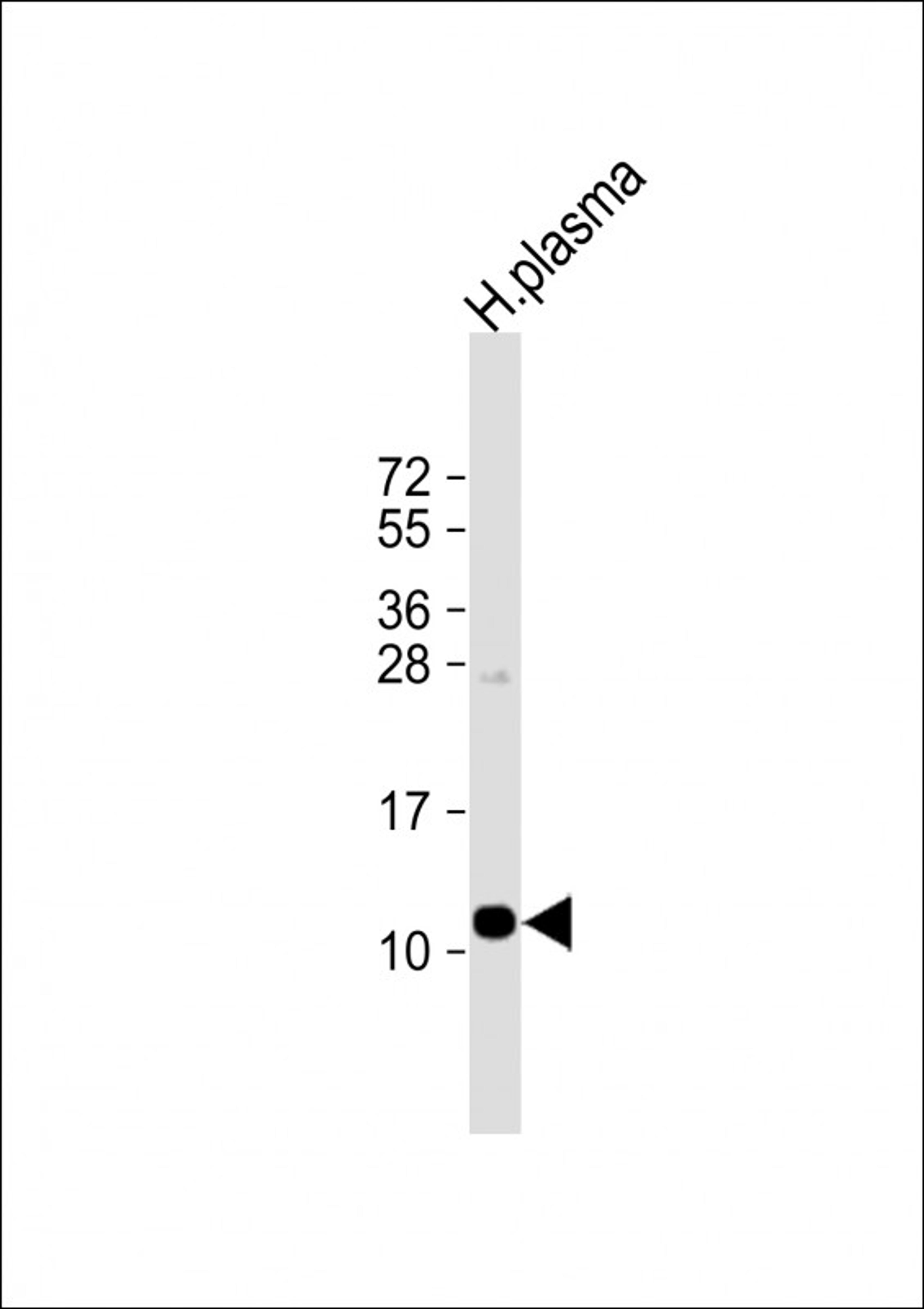 Western Blot at 1:1000 dilution + human plasma lysate Lysates/proteins at 20 ug per lane.