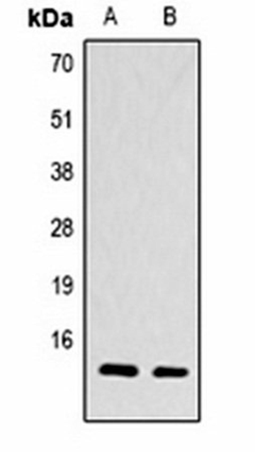 Western blot analysis of  Hela (Lane1), NIH3T3 (Lane2) whole cell lysates using Histone H4 (TriMethyl K79) antibody