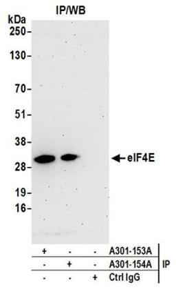 Detection of human eIF4E by western blot of immunoprecipitates.