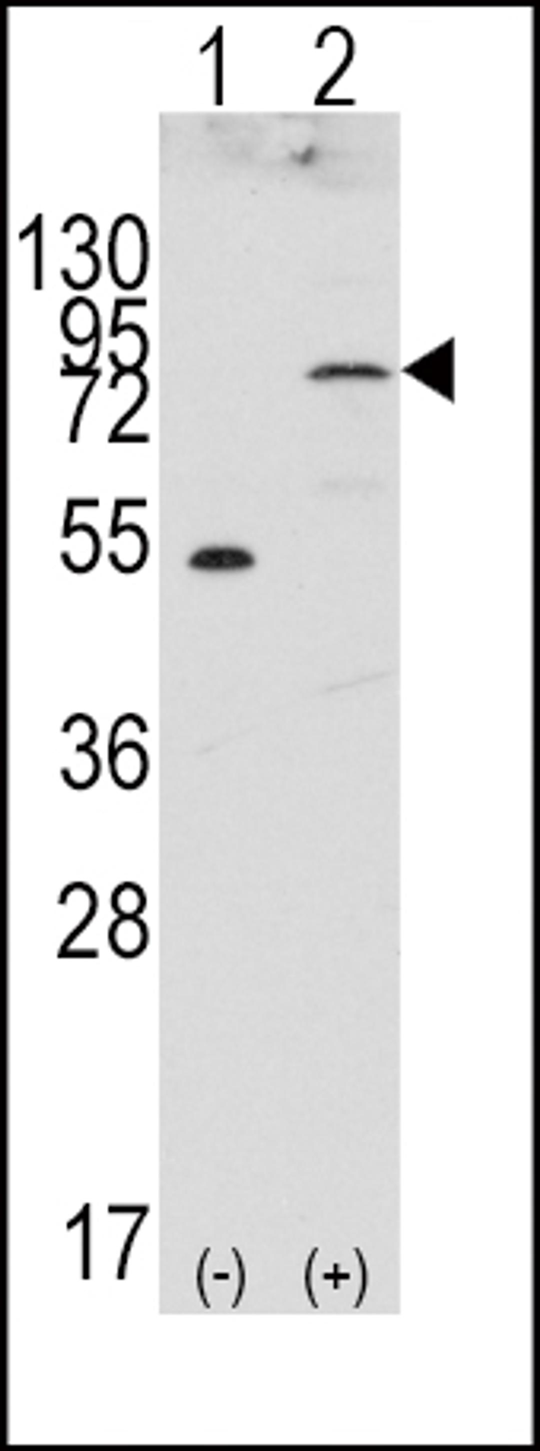 Western blot analysis of FGFR4 using rabbit polyclonal FGFR4 Antibody.293 cell lysates (2 ug/lane) either nontransfected (Lane 1) or transiently transfected with the FGFR4 gene (Lane 2).