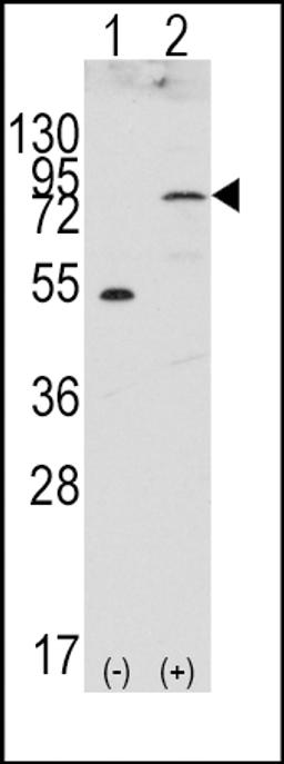 Western blot analysis of FGFR4 using rabbit polyclonal FGFR4 Antibody.293 cell lysates (2 ug/lane) either nontransfected (Lane 1) or transiently transfected with the FGFR4 gene (Lane 2).