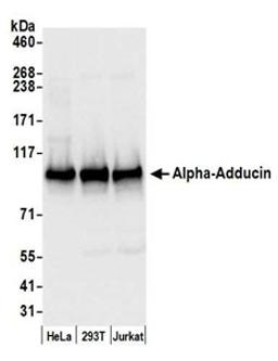 Detection of human Alpha-Adducin by western blot.