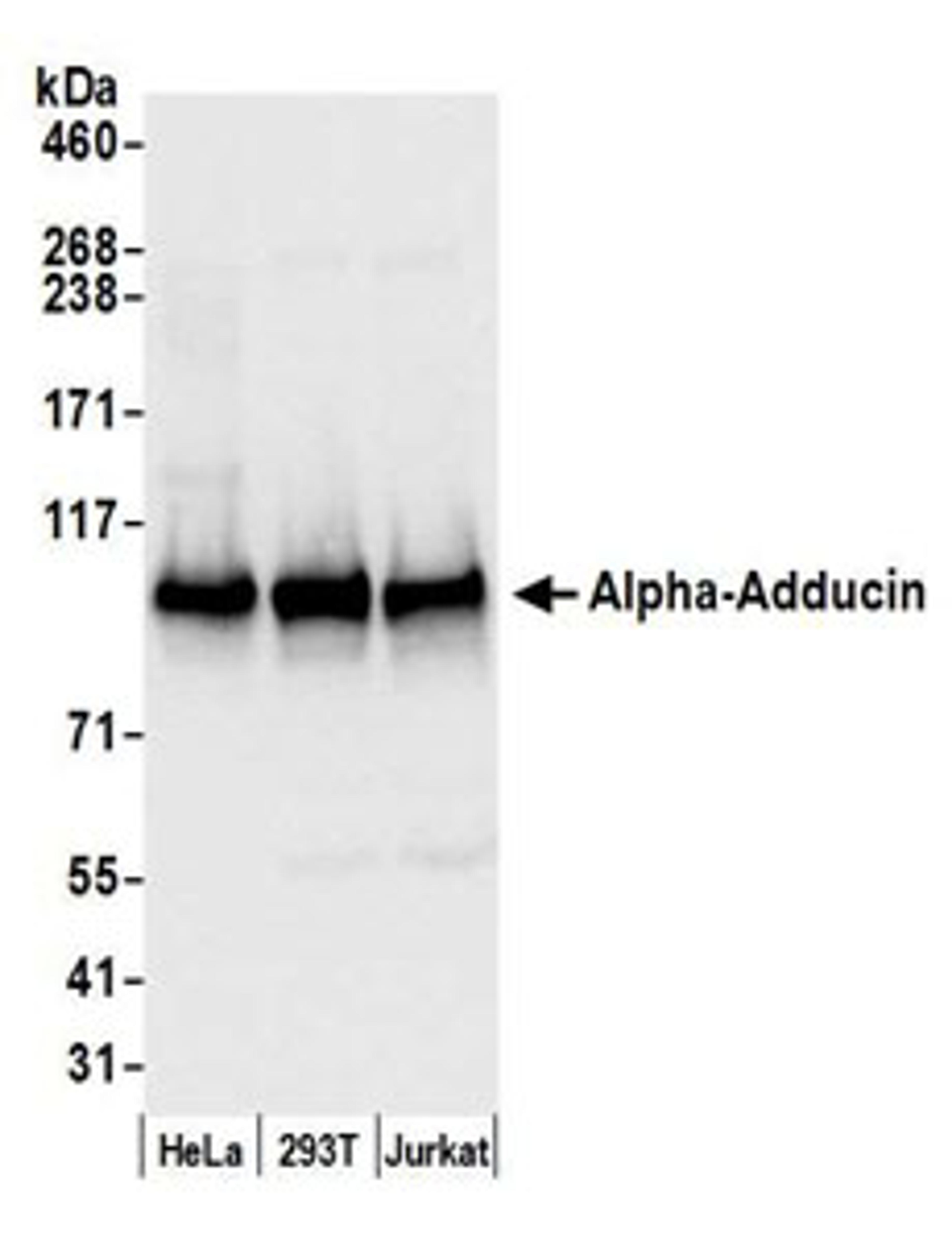 Detection of human Alpha-Adducin by western blot.