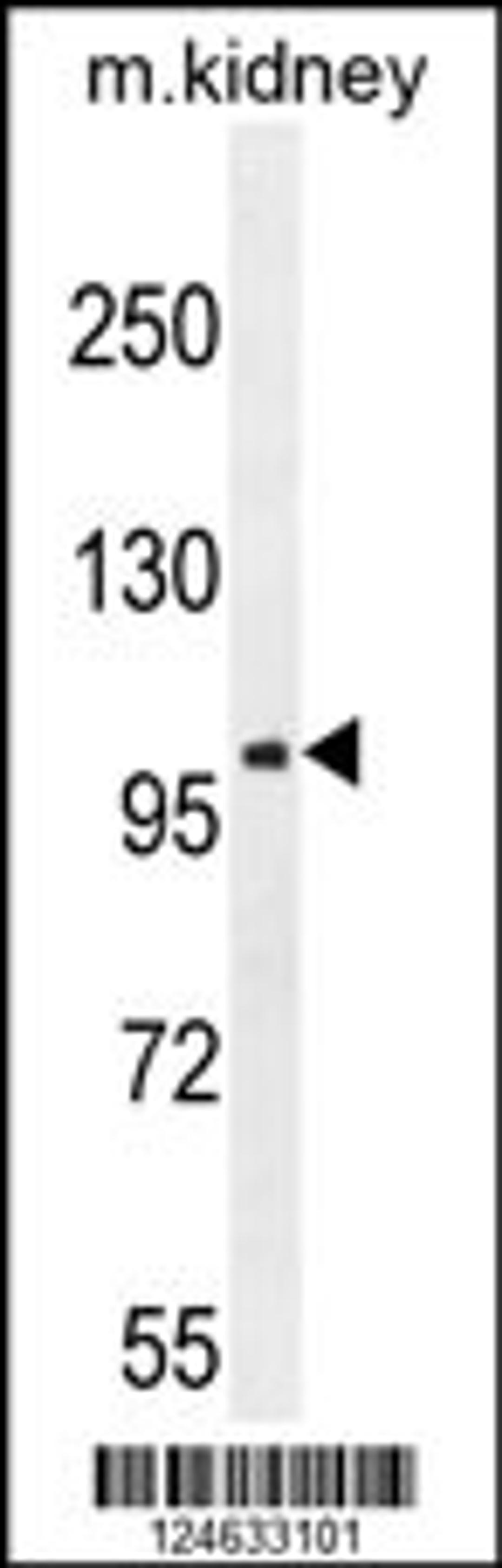 Western blot analysis in mouse kidney tissue lysates (35ug/lane).