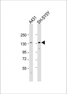 Western Blot at 1:2000 dilution Lane 1: A431 whole cell lysate Lane 2: SH-SY5Y whole cell lysate Lysates/proteins at 20 ug per lane.