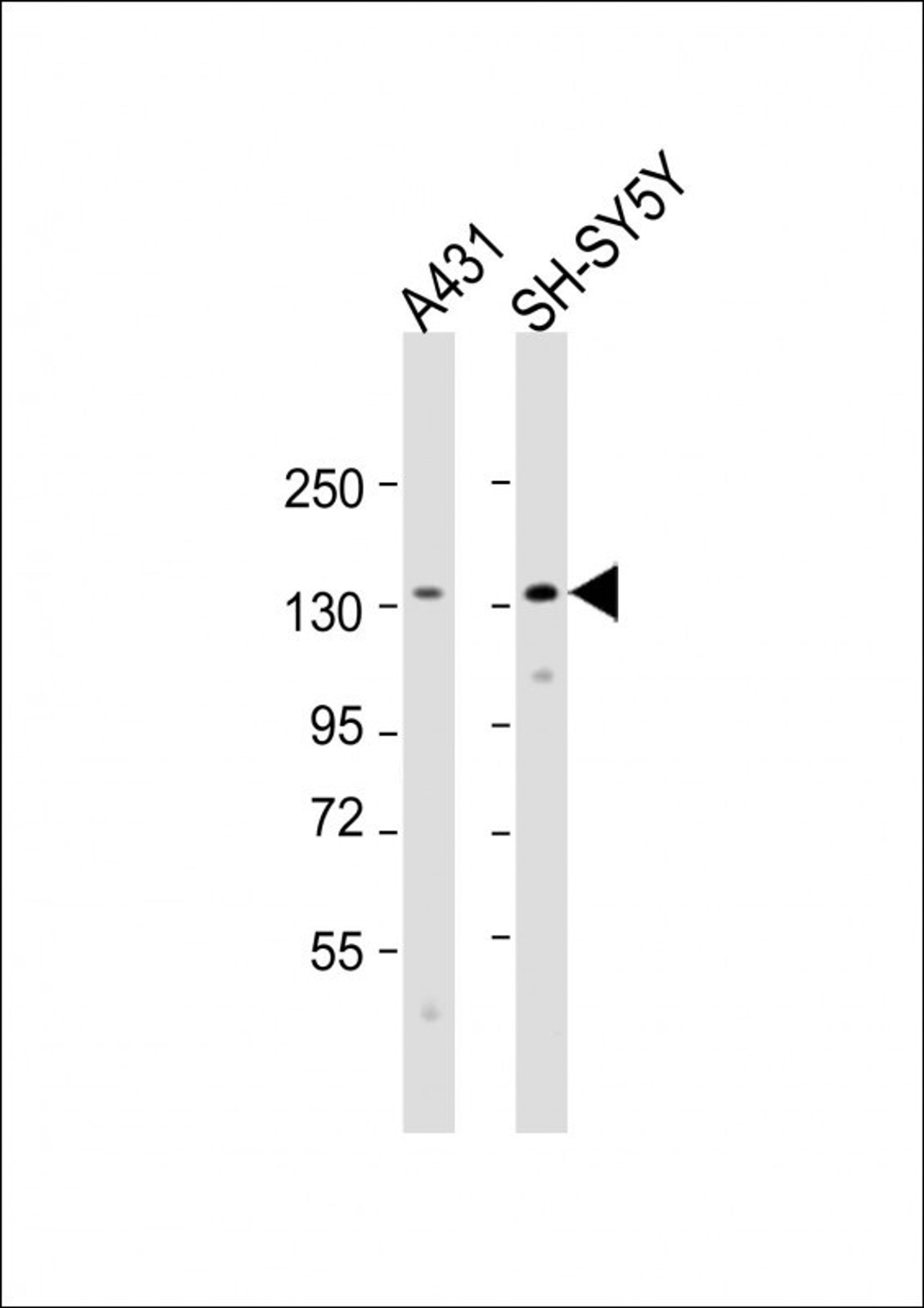 Western Blot at 1:2000 dilution Lane 1: A431 whole cell lysate Lane 2: SH-SY5Y whole cell lysate Lysates/proteins at 20 ug per lane.