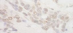 Detection of human IBP160 by immunohistochemistry.