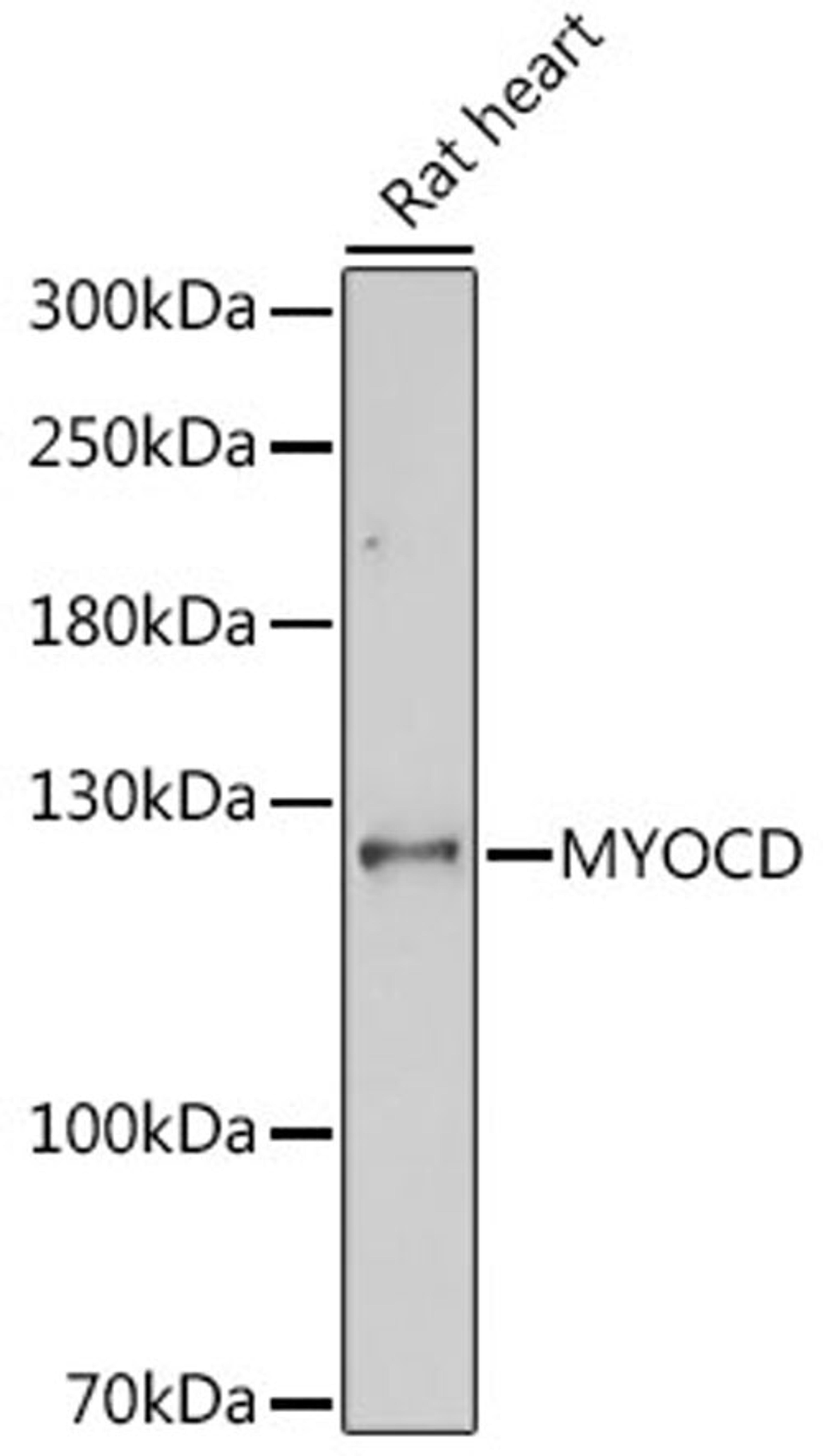 Western blot - MYOCD antibody (A16159)