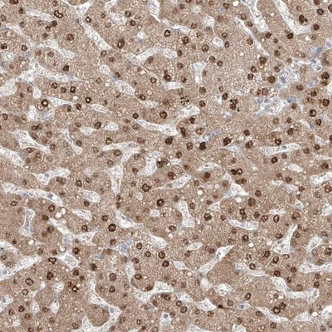 Immunohistochemistry-Paraffin: AOF1 Antibody [NBP1-90148] - Immunohistochemical staining of human liver shows nuclear and cytoplasmic positivity in hepatocytes.