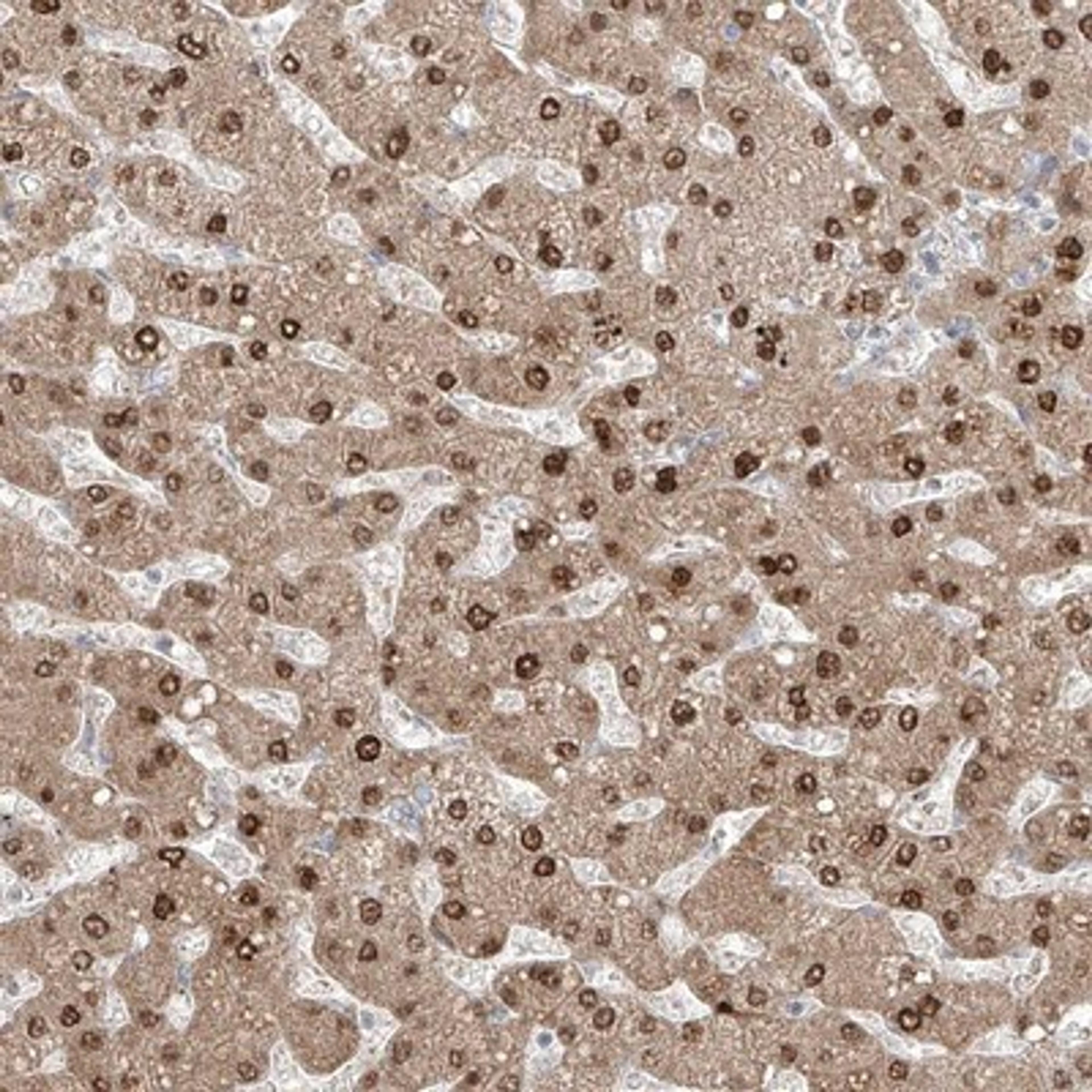 Immunohistochemistry-Paraffin: AOF1 Antibody [NBP1-90148] - Immunohistochemical staining of human liver shows nuclear and cytoplasmic positivity in hepatocytes.