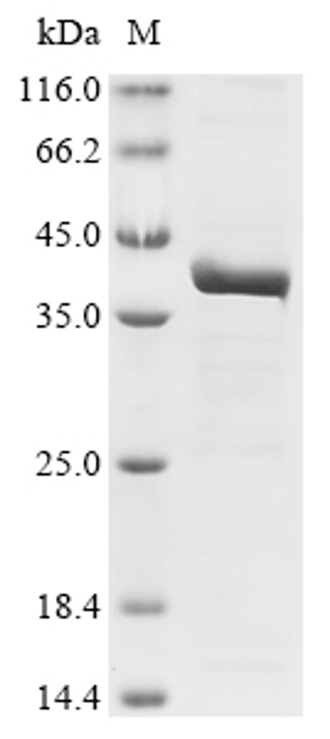 (Tris-Glycine gel) Discontinuous SDS-PAGE (reduced) with 5% enrichment gel and 15% separation gel.