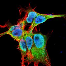 Immunofluorescence analysis of neuroblastoma cell line sk-n-be using FGFA antibody