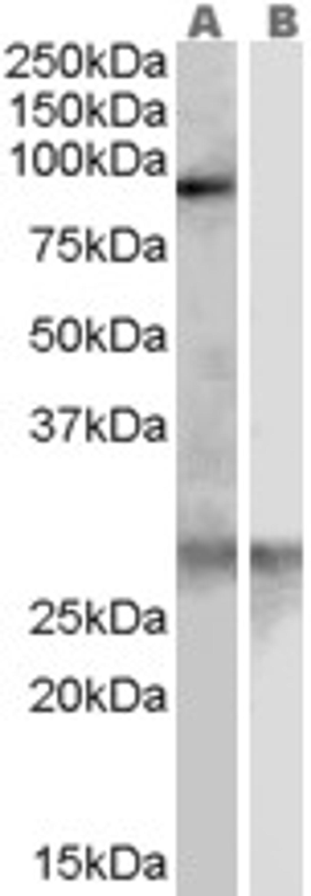 46-433 (0.3ug/ml) staining of Human Heart lysate (35ug protein in RIPA buffer) with (B) and without (A) blocking with the immunising peptide. Primary incubation was 1 hour. Detected by chemiluminescence.