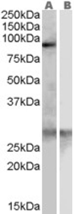 46-433 (0.3ug/ml) staining of Human Heart lysate (35ug protein in RIPA buffer) with (B) and without (A) blocking with the immunising peptide. Primary incubation was 1 hour. Detected by chemiluminescence.