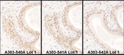 Detection of human USF2 by immunohistochemistry.