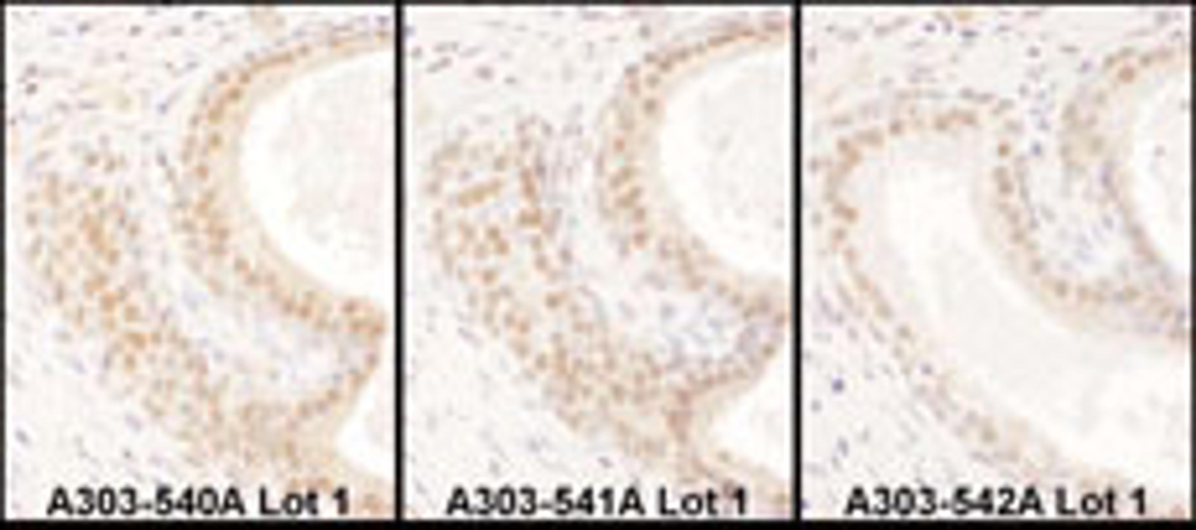 Detection of human USF2 by immunohistochemistry.