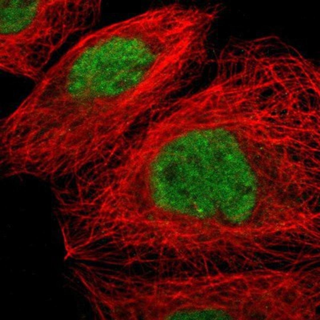 Immunocytochemistry/Immunofluorescence: ZNF350 Antibody [NBP1-80608] Staining of human cell line A-431 shows positivity in nucleus but not nucleoli.