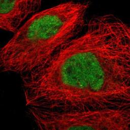 Immunocytochemistry/Immunofluorescence: ZNF350 Antibody [NBP1-80608] Staining of human cell line A-431 shows positivity in nucleus but not nucleoli.