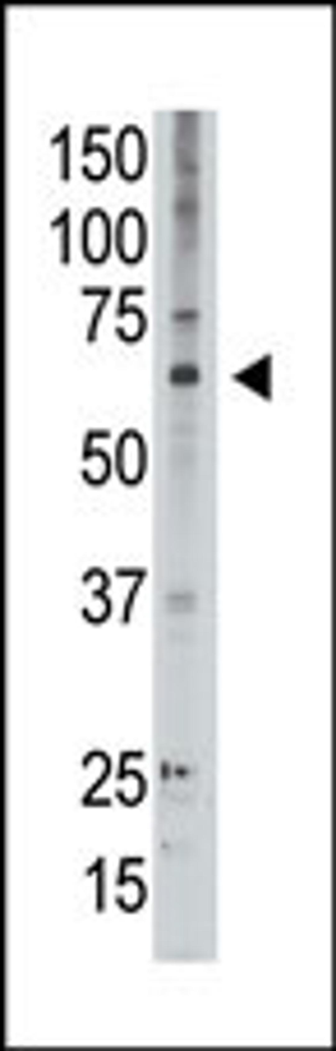 Antibody is used in Western blot to detect MAGED2 in A549 lysate.