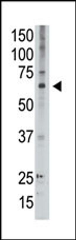 Antibody is used in Western blot to detect MAGED2 in A549 lysate.