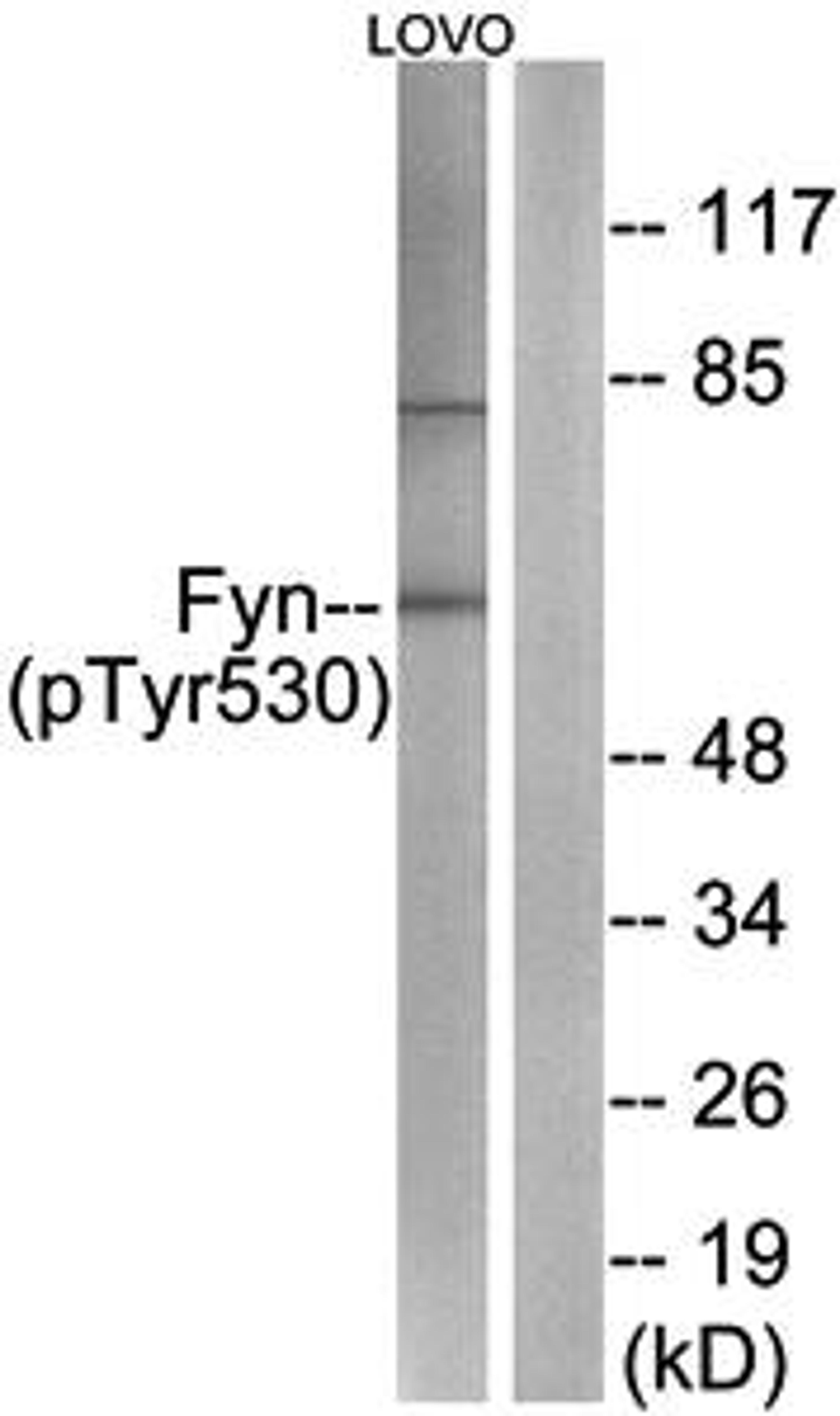 Western blot analysis of extracts from LOVO cells using Fyn (Phospho-Tyr530) antibody