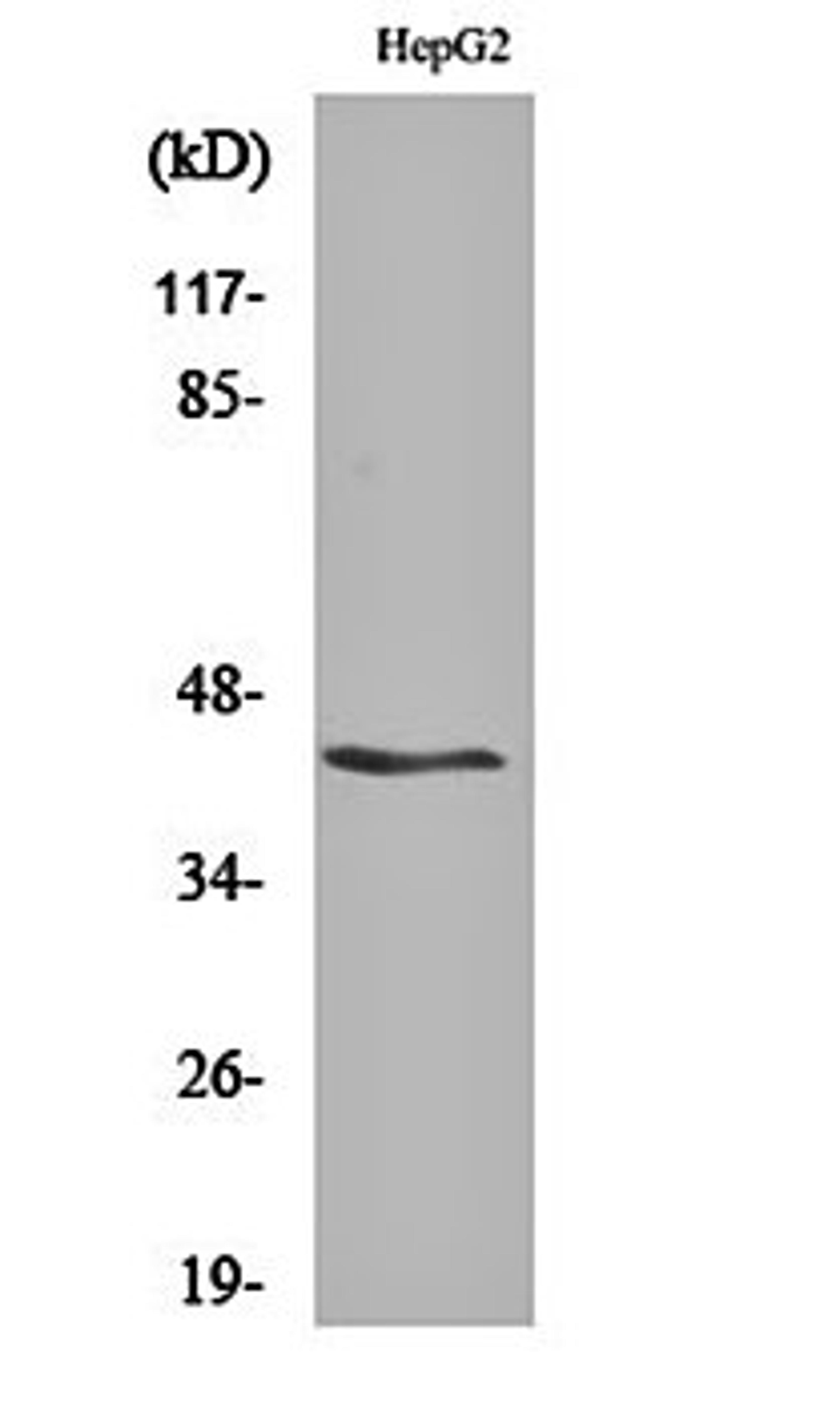 Western blot analysis of HepG2 cell lysates using KV beta.3 antibody