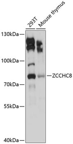 Western blot - ZCCHC8 antibody (A9563)