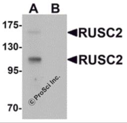 Western blot analysis of RUSC2 in SK-N-SH cell lysate with RUSC2 antibody at 1 μg/mL in (A) the absence and (B) the presence of blocking peptide