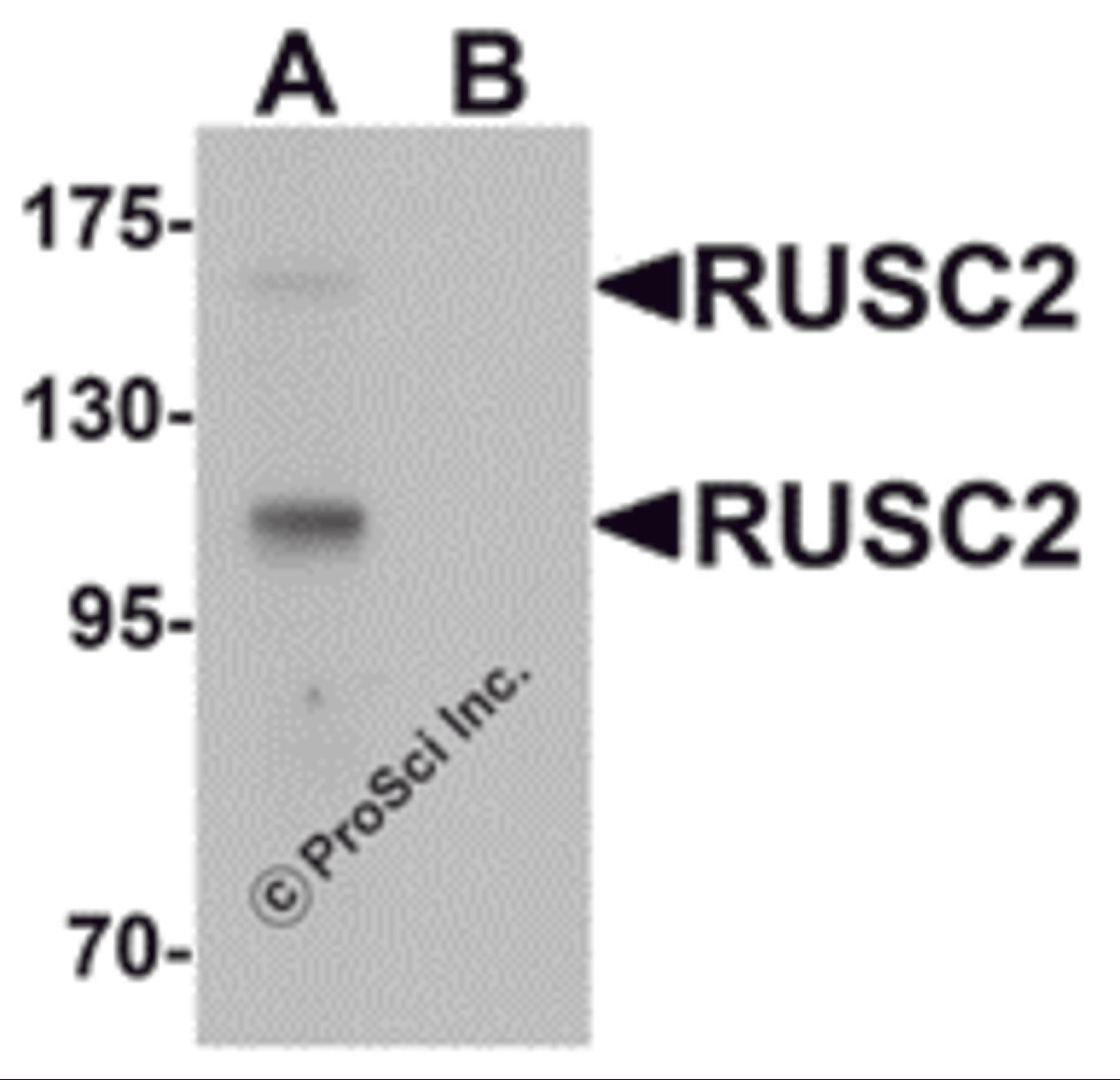 Western blot analysis of RUSC2 in SK-N-SH cell lysate with RUSC2 antibody at 1 μg/mL in (A) the absence and (B) the presence of blocking peptide