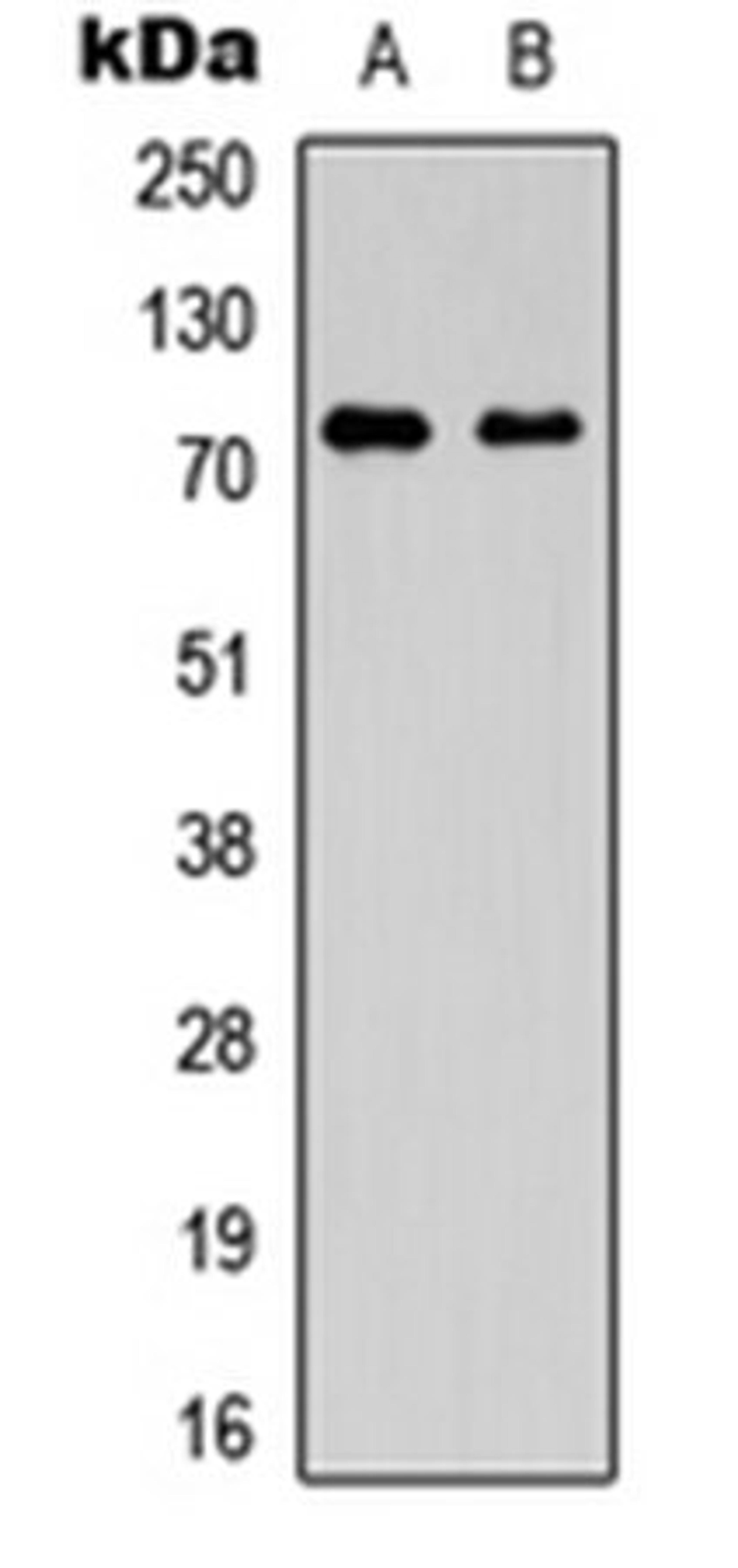 Western blot analysis of A549 (Lane 1), Jurkat (Lane 2) whole cell lysates using CD92 antibody