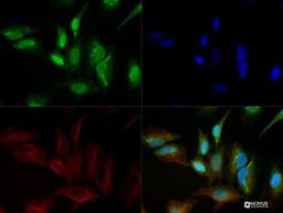 Immunocytochemistry/ Immunofluorescence: FBX09 Antibody [NBP2-27364] - ICC-IF validation of FBX09 antibody on HeLa cells at 1:100 dilution with detection using Dylight 488 - conjugated secondary antibody (Green). Alpha tubulin and nuclei were counterstained against Dylight 568 (Red) and DAPI (Blue), respectively.