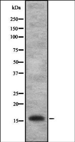 Western blot analysis of HEK293 cells using IL1FA antibody