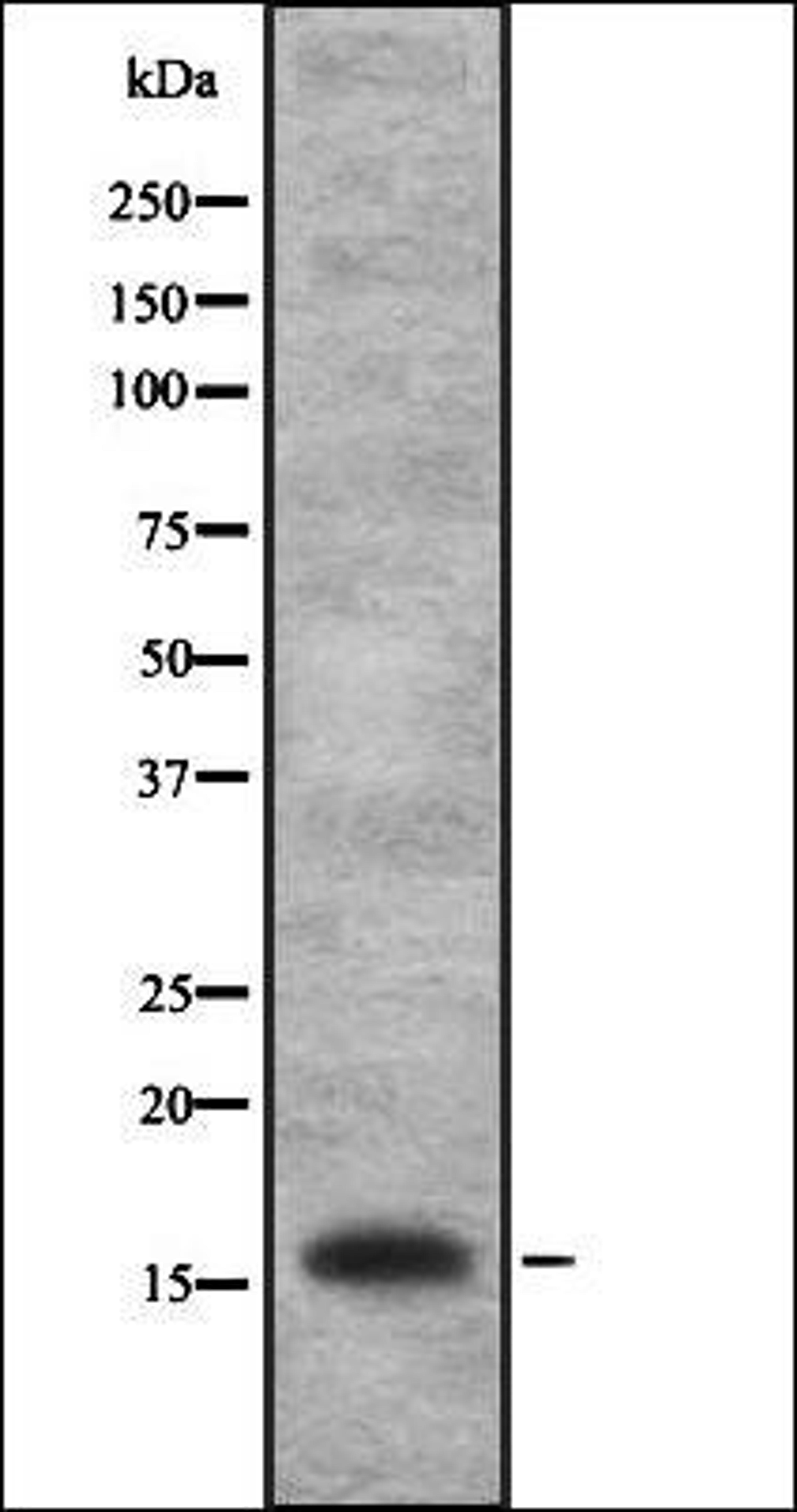 Western blot analysis of HEK293 cells using IL1FA antibody