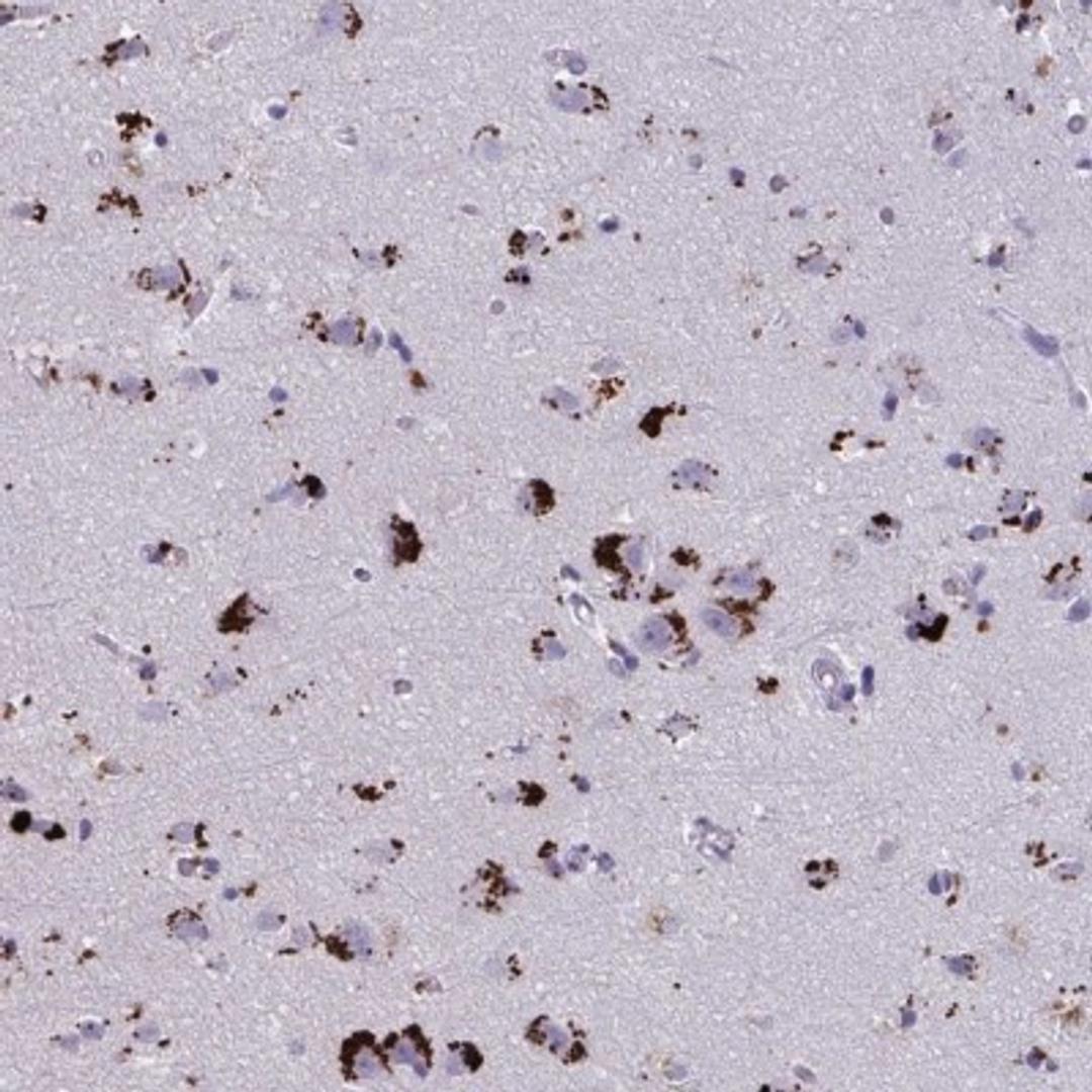 Immunohistochemistry-Paraffin: GPR162 Antibody [NBP2-33740] - Immunohistochemical staining of human cerebral cortex shows strong cytoplasmic positivity in neuronal cells.