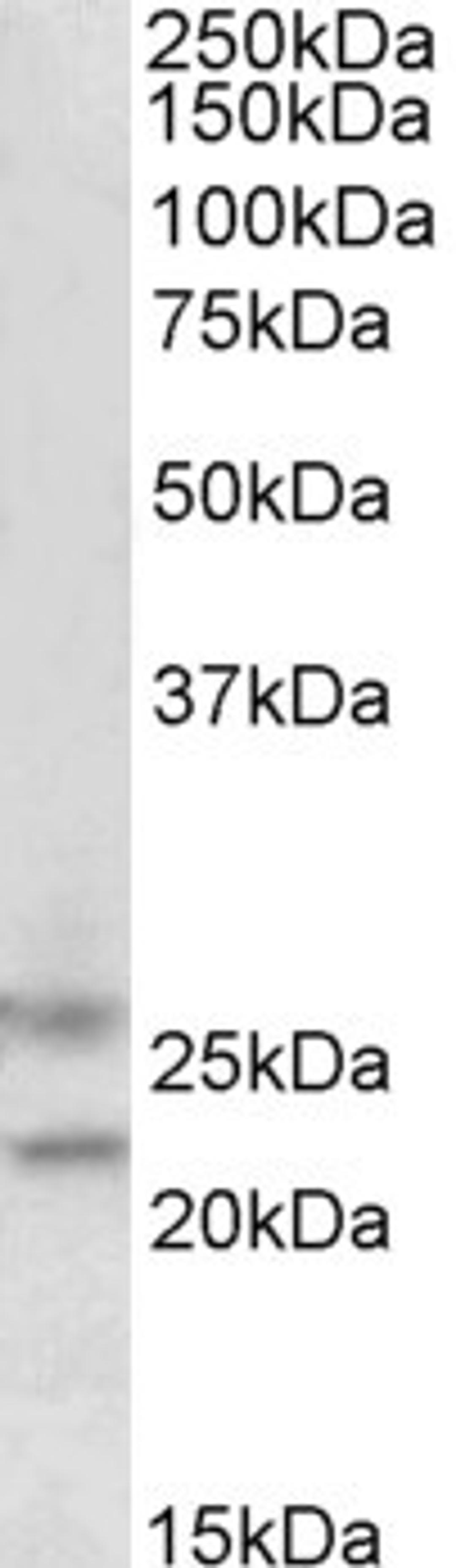 45-581 (1.5ug/ml) staining of Human Brain (cerebellum) lysate (35ug protein in RIPA buffer). Primary incubation was 1 hour. Detected by chemiluminescence.