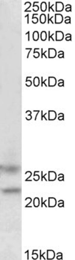 45-581 (1.5ug/ml) staining of Human Brain (cerebellum) lysate (35ug protein in RIPA buffer). Primary incubation was 1 hour. Detected by chemiluminescence.