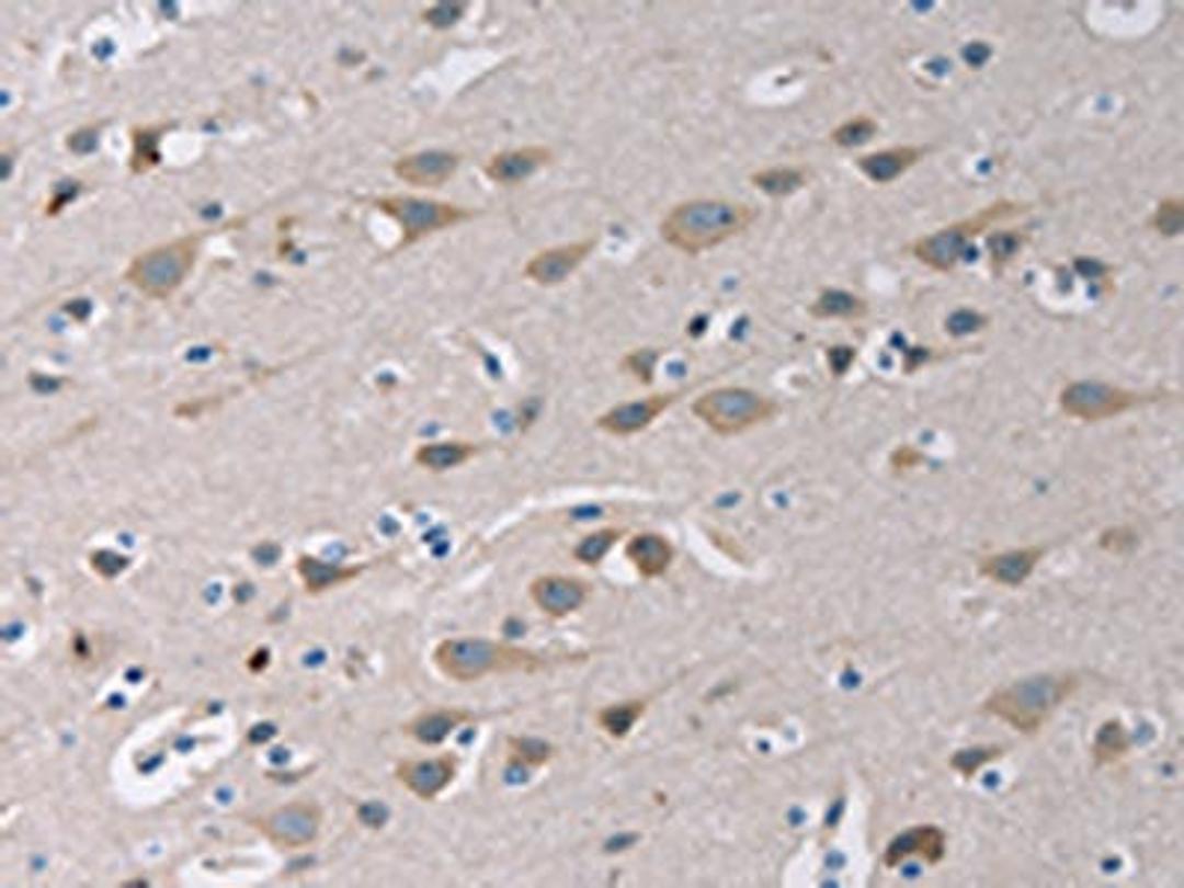 The image on the left is immunohistochemistry of paraffin-embedded Human brain tissue using CSB-PA953581(TLR1 Antibody) at dilution 1/20, on the right is treated with fusion protein. (Original magnification: ×200)