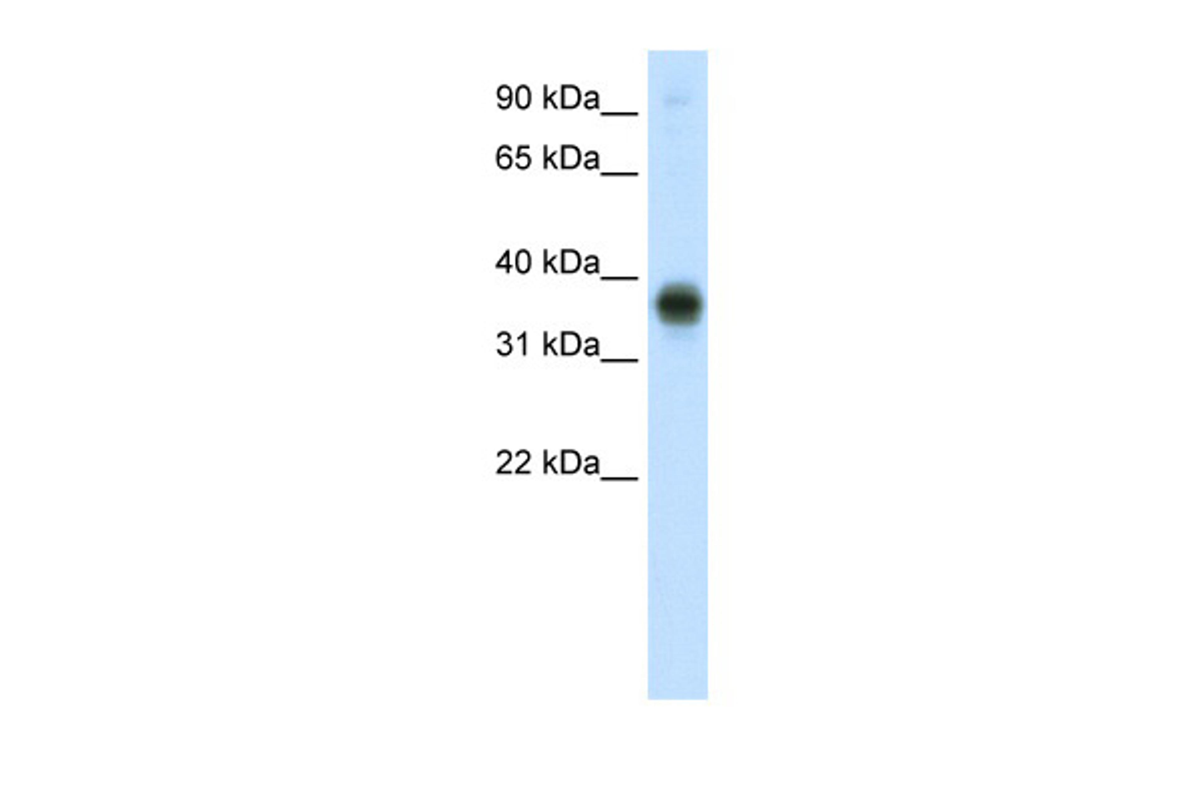 Antibody used in WB on Human Thymus at 0.2-1 ug/ml.