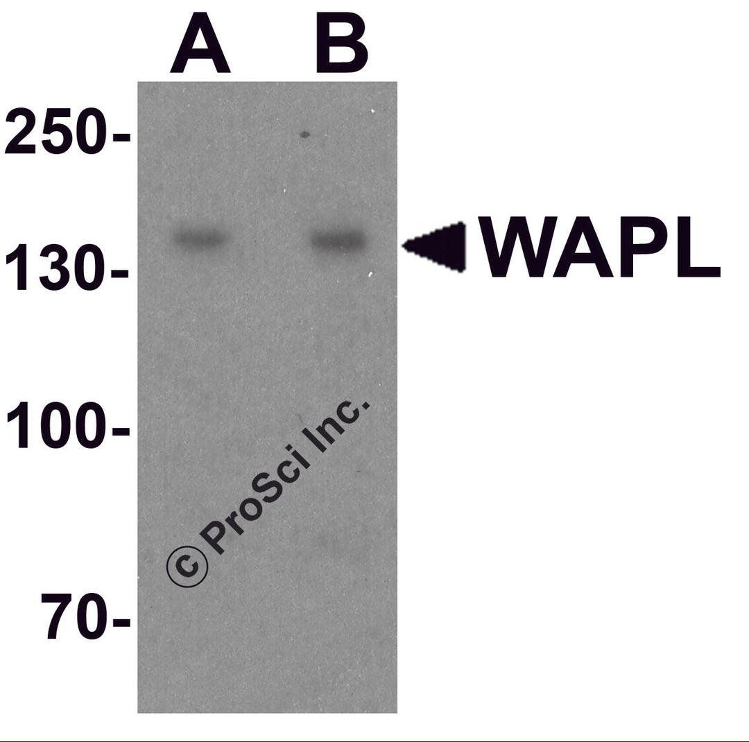 Western blot analysis of WAPL in A20 cell lysate with WAPL antibody at (A) 1 and (B) 2 &#956;g/ml.