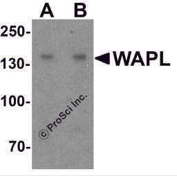 Western blot analysis of WAPL in A20 cell lysate with WAPL antibody at (A) 1 and (B) 2 &#956;g/ml.