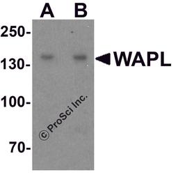Western blot analysis of WAPL in A20 cell lysate with WAPL antibody at (A) 1 and (B) 2 μg/ml.
