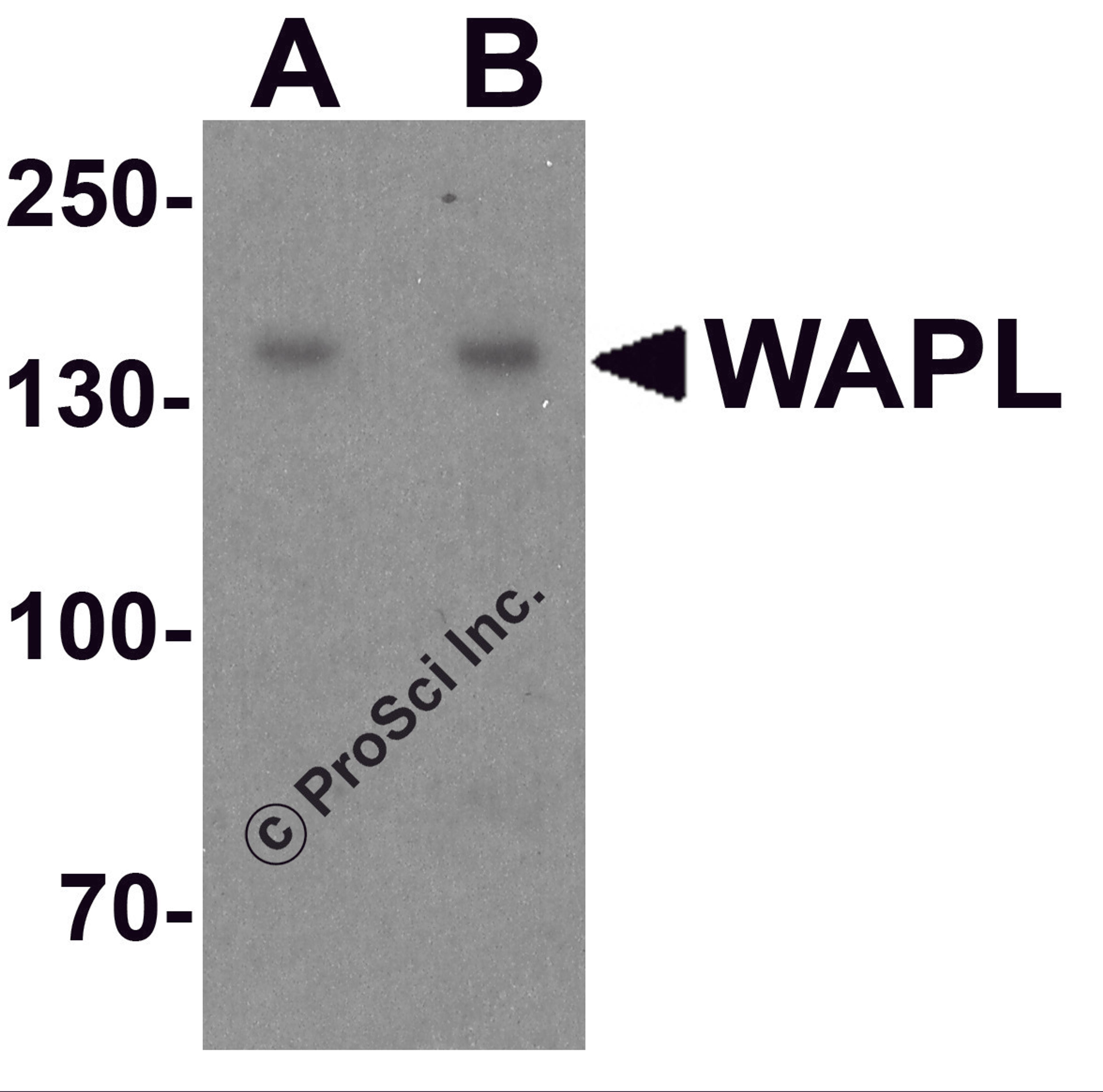 Western blot analysis of WAPL in A20 cell lysate with WAPL antibody at (A) 1 and (B) 2 μg/ml.